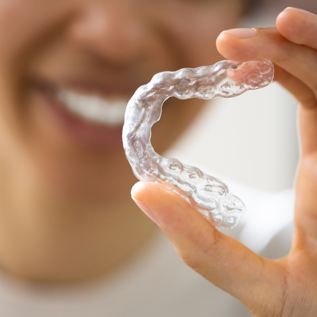 benefits of clear aligners